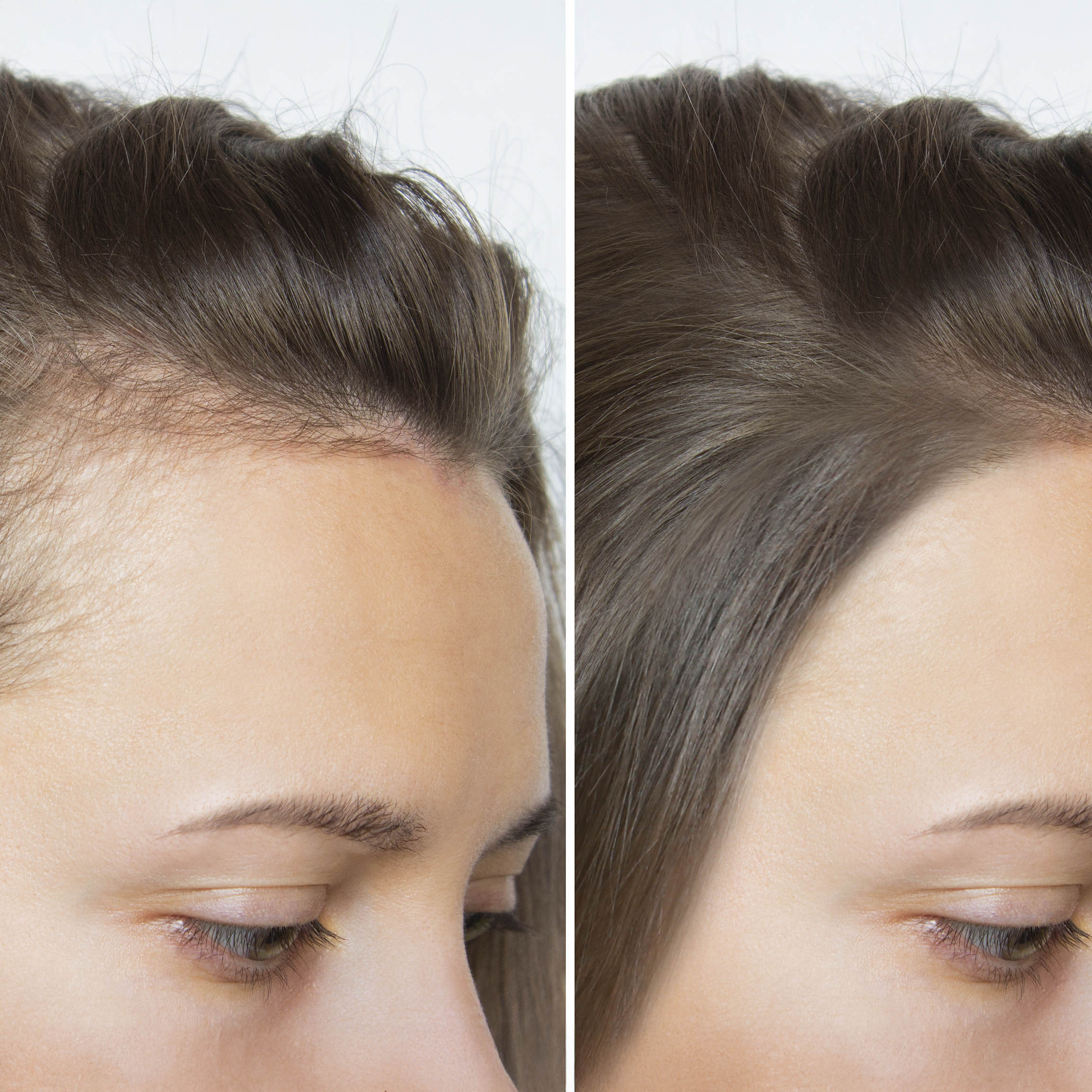 Shampoo Anticaída Natural con Romero, Cafeína y Aloe | Fortalece y Estimula el Crecimiento